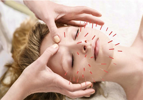 Acupuncture for detox
