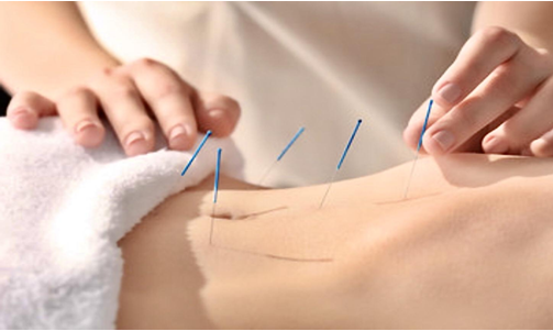 Acupuncture for detox
