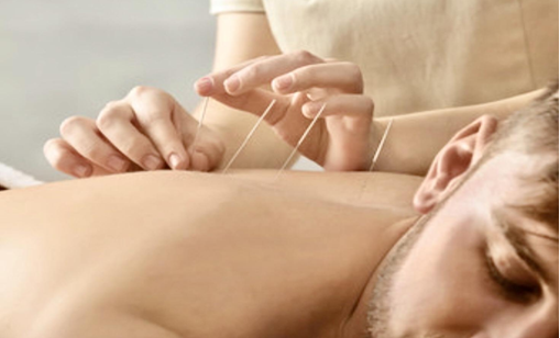 Acupuncture for detox